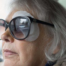 Pós-cirurgia ocular: médico descreve sinais esperados - DINO