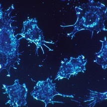 Conjugados anticorpo-droga: a revolução na oncologia