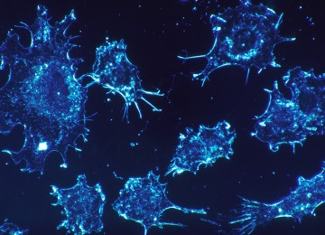 Células cancerígenas vistas do microscópio  -  (crédito: PxHere)