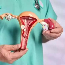 Mulher preserva fertilidade ao mover útero de lugar para tratamento com radioterapia - Getty Images