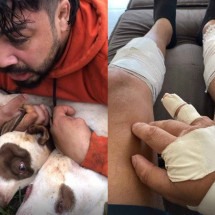 Lutador de muay thai imobiliza pitbulls após ataque: 'Achei que ia morrer'