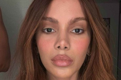 O que Anitta fez no rosto? Assessoria da cantora se pronuncia após especulações sobre novos procedimentos estéticos -  (crédito: Observatório dos Famosos)