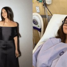 Tricotilomania: distúrbio faz atriz de 'X-Men' arrancar o cabelo - Redes Sociais/Divulgação 