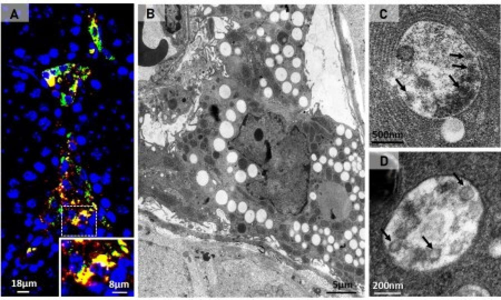 Células testiculares infectadas pelo SARS-CoV-2. A) Proteína Spike viral (em amarelo); B) Citoplasma repleto de de lipídios contendo colesterol; C e D) Partículas virais (setas) no lipídio e no interior da vesícula da célula