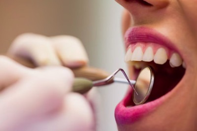 Após essa fase, o foco será avaliar a eficiência do medicamento. Para isso, será feita a administração da substância em pacientes com agenesia dentária, ou seja, quando os dentes não se desenvolvem desde o nascimento. -  (crédito: freepik wavebreakmedia_micro)
