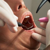 Cirurgiões-dentistas e o câncer de cabeça e pescoço: entenda a relação - carocaro1987/Unsplash