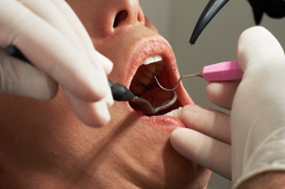Dentro de uma abordagem multidisciplinar, cirurgiões-dentistas atuam com foco nos tumores da cavidade oral -  (crédito: carocaro1987/Unsplash)