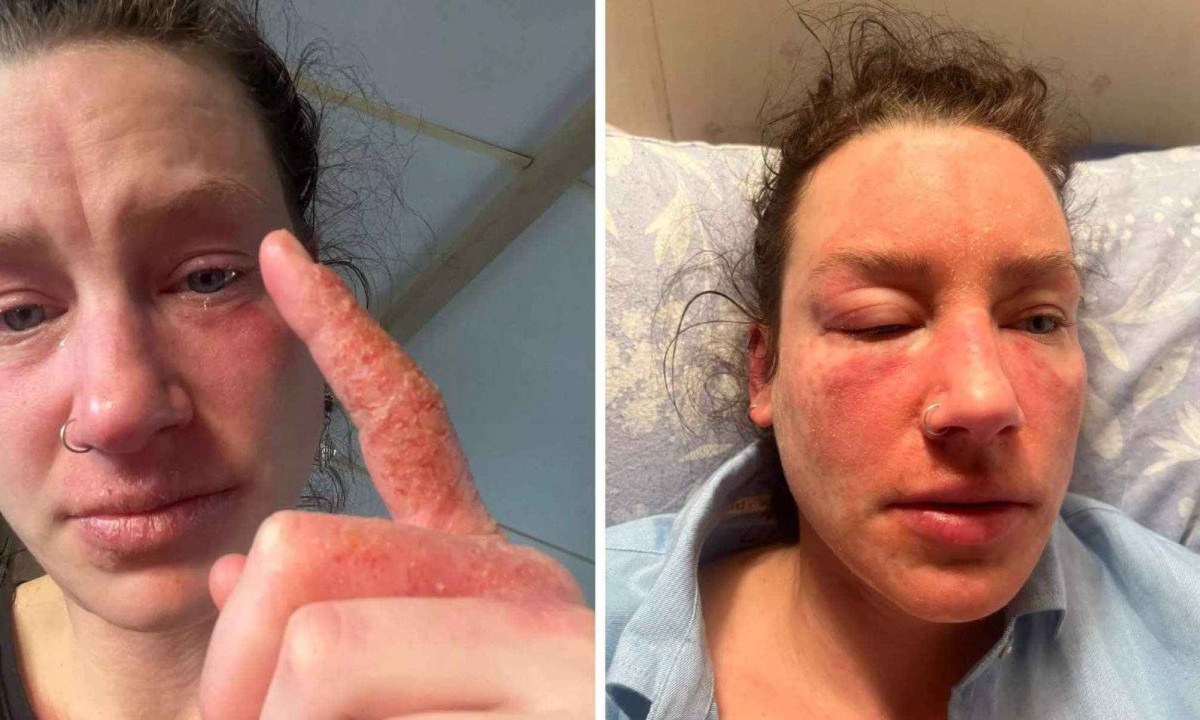 O sofrimento de Francesca Tebbutt dura quase dois anos Sofrimento dura quase dois anos
