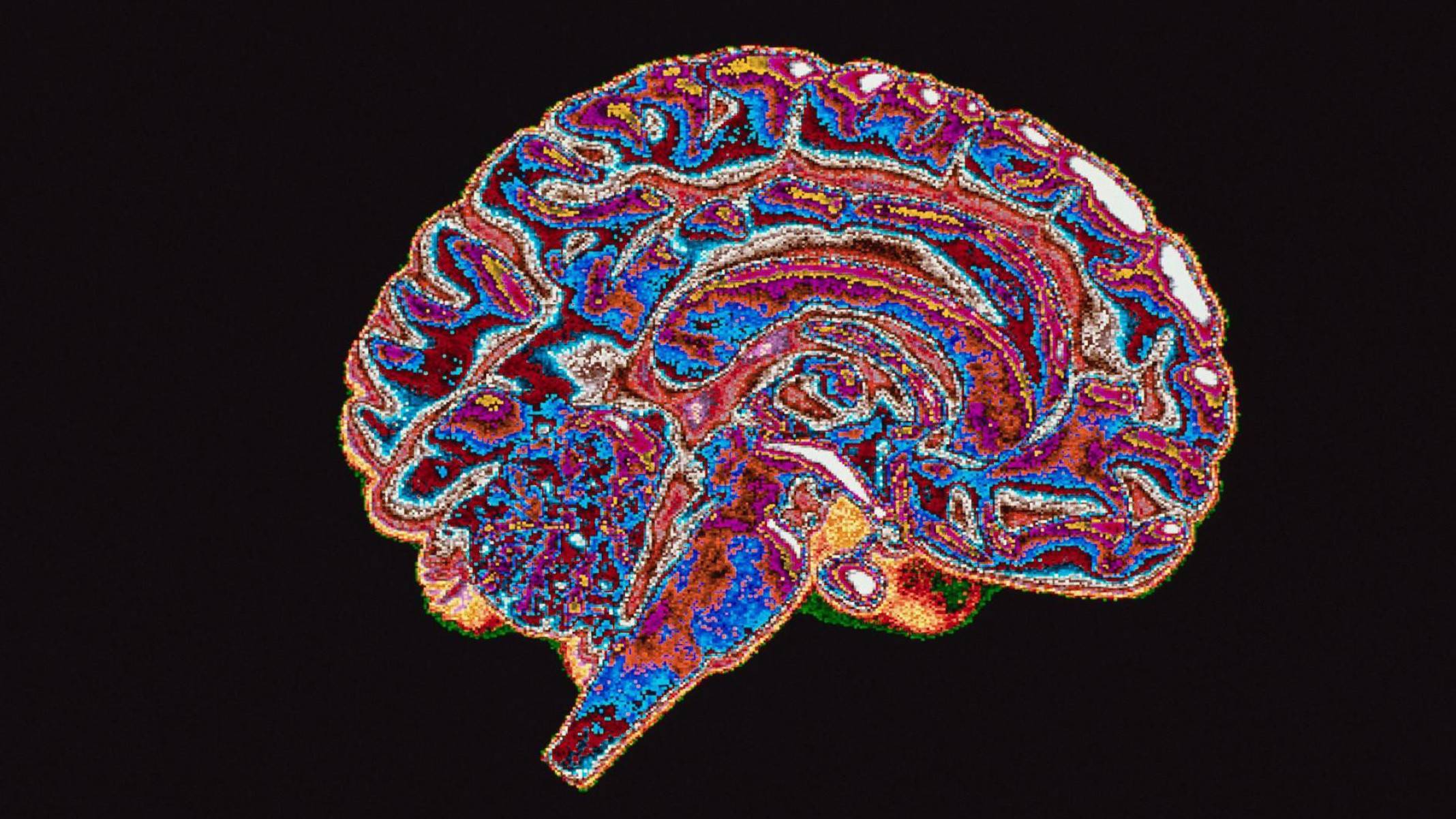 Os seres humanos são corruptos por natureza? O que diz a neurociência - Getty Images