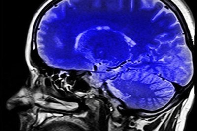 Em várias etapas da vida, o corpo humano deve receber nutrientes e vitaminas necessárias para o seu bom funcionamento. Assim, estudos demonstram que um composto orgânico pouco conhecido é fundamental para que o sistema nervoso humano fique saudável: Colina. -  (crédito: - Dominio Publico/hippopx.com)