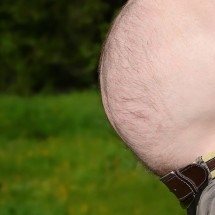 Barriga de cerveja? Especialista alerta para riscos sérios à saúde