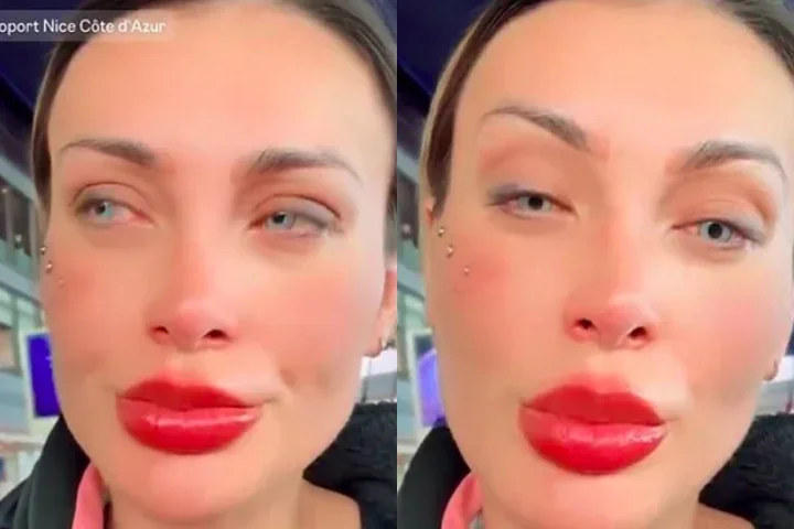 Andressa Urach se arrepende após cirurgia para mudar cor dos olhos - Montagem/Reprodução/Redes Sociais 