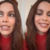 Anitta nega problemas de saúde e confirma procedimentos estéticos: "O corpo é meu" - Montagem/Reprodução/Redes Sociais