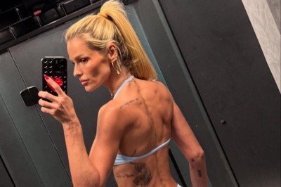 O lipedema tem causa inflamatória e está associado à ação dos hormônios femininos -  (crédito: Instagram/reprodução)