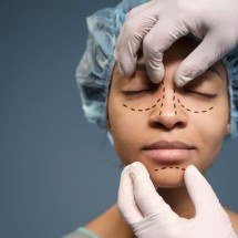 Cirurgia de pálpebra é a nova plástica mais realizada no mundo - FreePik
