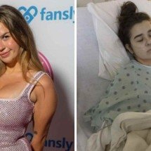 Modelo de 23 anos quase morre após tragada em cigarro contaminado com mofo - redes sociais