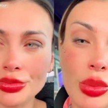 Andressa Urach se arrepende depois de cirurgia para mudar cor dos olhos - Montagem/Reprodução/Redes Sociais 