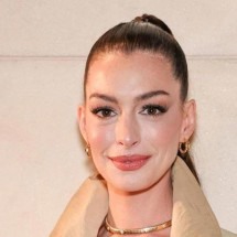 A atriz Anne Hathaway foi alvo dessas especulações quando surgiu com a pele com um aspecto mais liso e um olhar mais levantado -  (crédito: Redes Sociais/Reprodução)