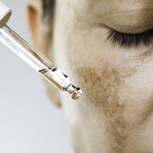 Melasma, rugas e poros dilatados: como tratar os maiores vilões da pele? - FreePik