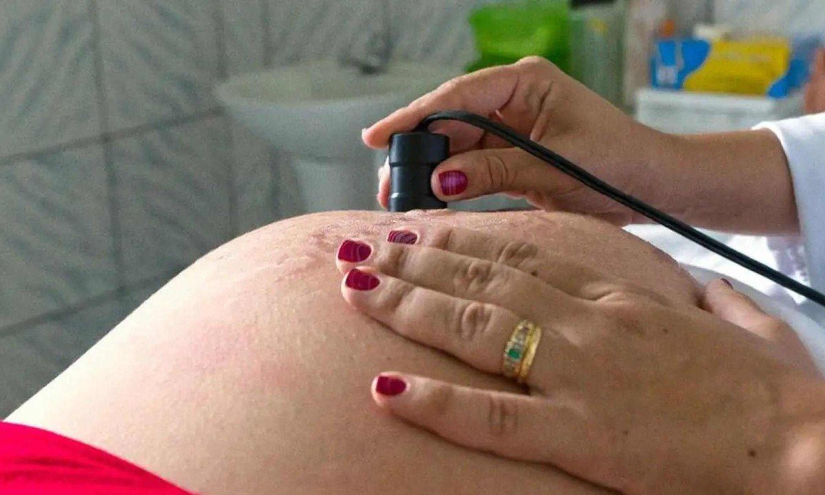 Pesquisa identificou que mulheres que não realizaram consulta pré-natal durante o início da gravidez tiveram 47% mais chances de ter um bebê com anomalias  -  (crédito: Arquivo/MDS)