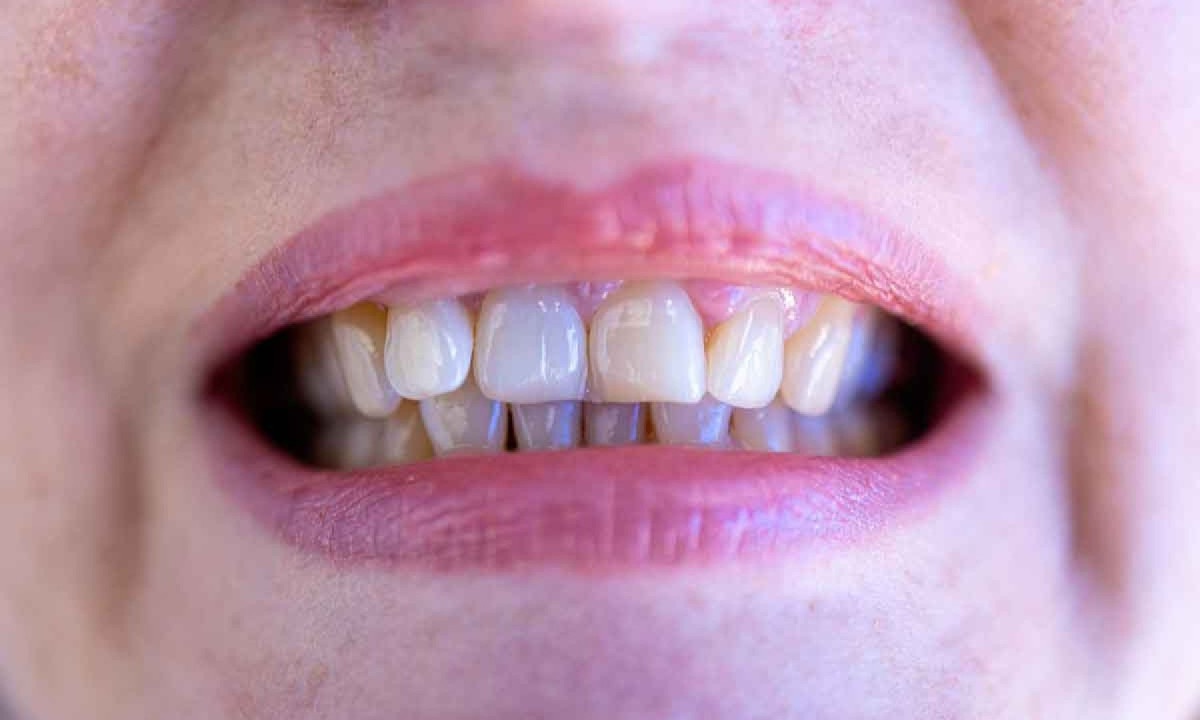 Atendimento odontológico doméstico acabou. Agora, só no consultório
 -  (crédito: Pixabay/reprodução)