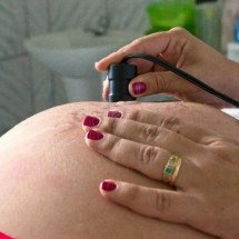 Exame pré-natal reduz chance de bebê nascer com anomalia