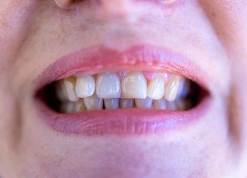 Atendimento odontológico doméstico acabou. Agora, só no consultório
 -  (crédito: Pixabay/reprodução)