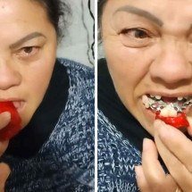 Morango do amor: receita dá errado e mulher perde dentes com doce da moda - Reprodução / TikTok