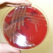 Pneumonia e meningite: estudo analisa a resistência da bactéria causadora - Pavel Dušek/Wikimedia Commons/Reprodução