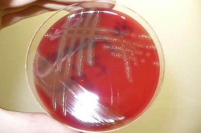Pneumococos mutantes que não produzem proteína PspA são mais vulneráveis à eliminação por indolicidina -  (crédito: Pavel Dušek/Wikimedia Commons/Reprodução)