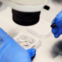Teste inédito reduz risco de doenças hereditárias - istockphotos