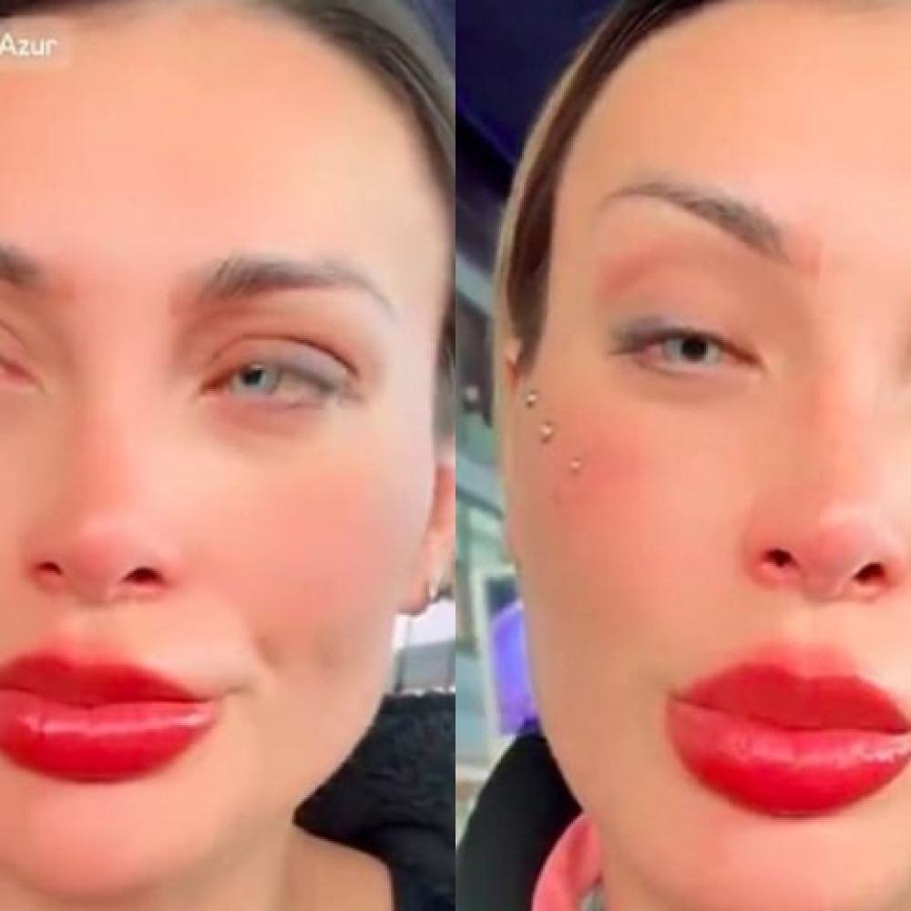 Andressa Urach se arrepende de cirurgia para mudar cor dos olhos - Montagem/Reprodução/Redes Sociais 