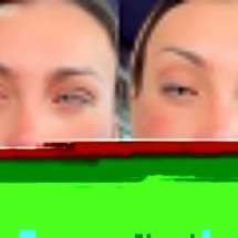 Andressa Urach se arrepende de cirurgia para mudar cor dos olhos - Montagem/Reprodução/Redes Sociais 