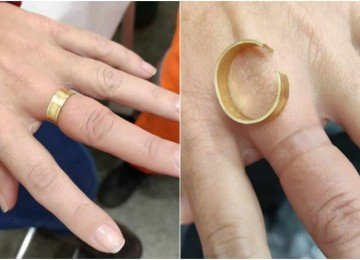 Somente em julho, considerando a ocorr&ecirc;ncia desta quinta-feira, j&aacute; s&atilde;o 48 atendimentos no estado para remo&ccedil;&atilde;o de alian&ccedil;a presa ao dedo -  (crédito: CBMMG)