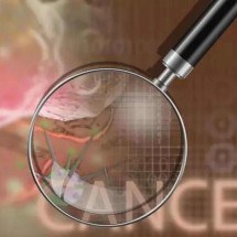 Como a Inteligência Artificial está transformando o combate ao câncer  - Invitrocue Brasil/Divulgação