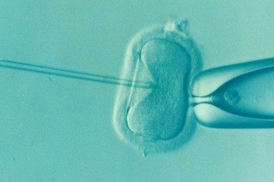 A fertilização in vitro (FIV) é uma técnica de reprodução assistida que consiste em fecundar o óvulo com o espermatozoide fora do corpo da mulher, em laboratório.  -  (crédito: Elena ????? Kontogianni ???????????/Pixabay)