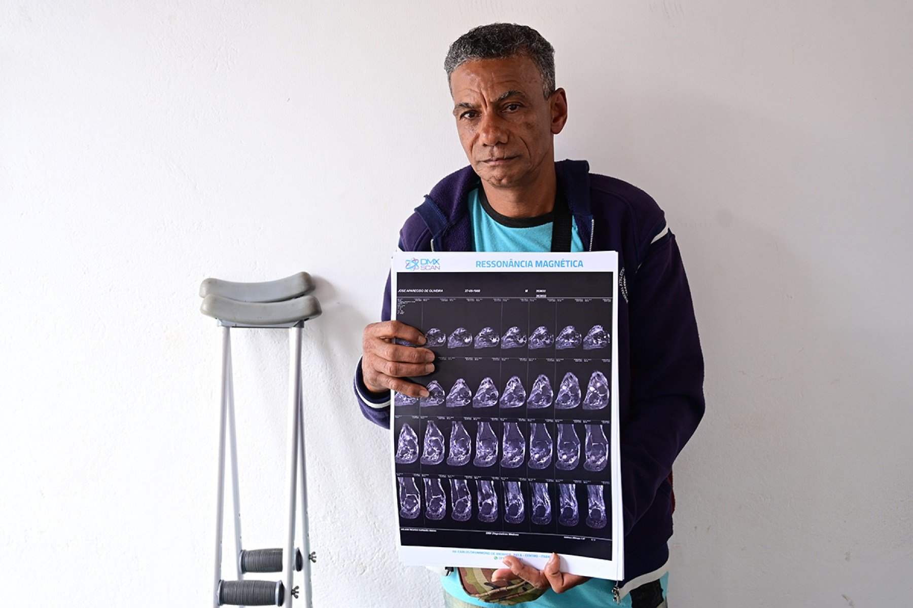 Morador da cidade, JosÃ© Aparecido de Oliveira, 57, anda de muletas, mal consegue se firmar em pÃ©. Aguarda uma nova operaÃ§Ã£o, a ser marcada em BH, o que exige paciÃªncia diante da longa demanda. 