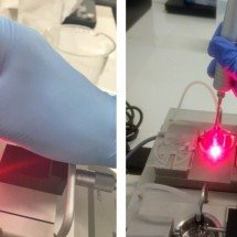 Laser pode ajudar a combater hipertensão desencadeada pela menopausa - Gerson Rodrigues/UFSCar/Reprodução