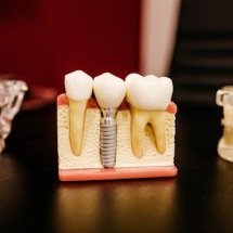 Diabéticos podem fazer implantes dentários? O que é preciso saber? - Jonathan Borba/Unsplash