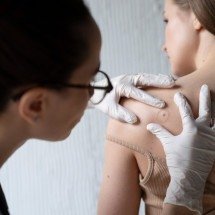 Furúnculo pode matar? Os perigos da manipulação caseira da infecção - FreePik