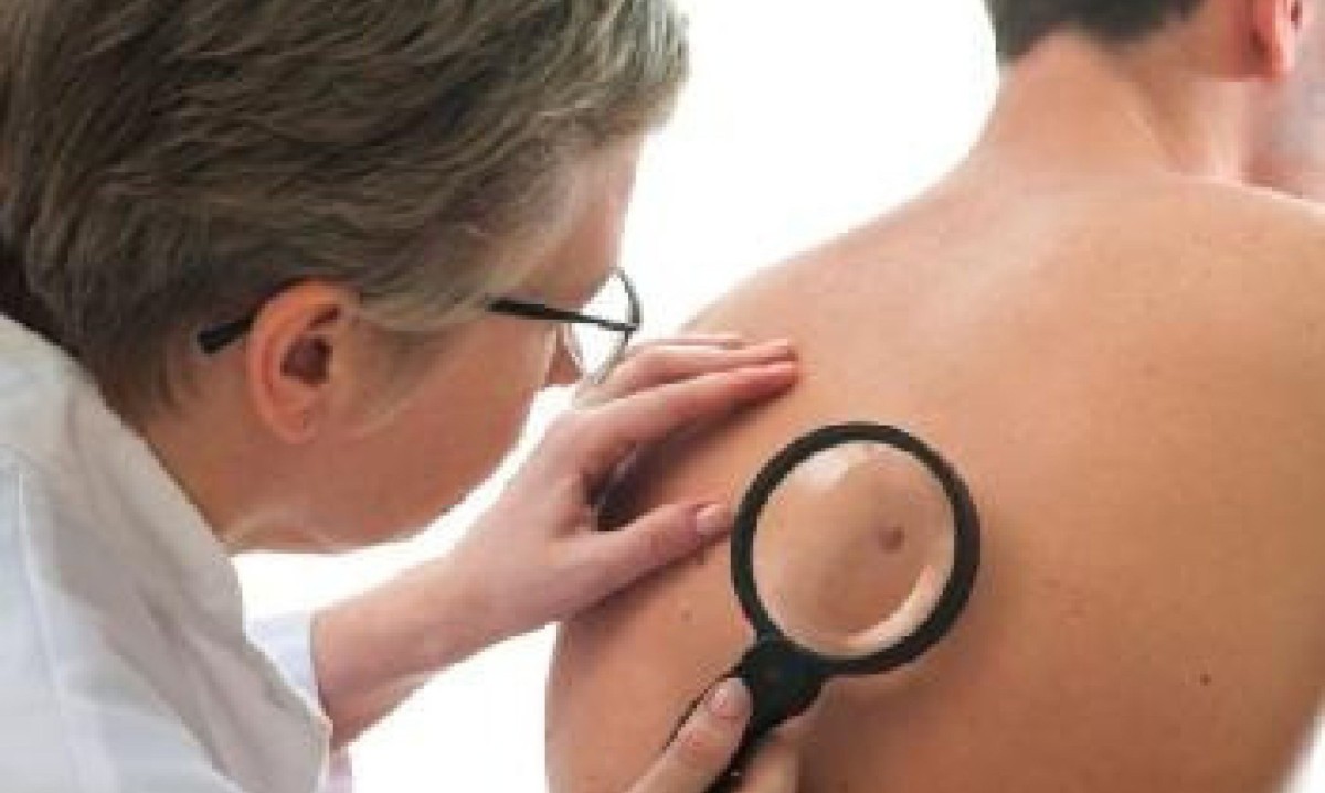 O melanoma pode se desenvolver em qualquer parte do corpo, mesmo em locais que não recebem muita exposição solar, como os pés -  (crédito: Freepik)