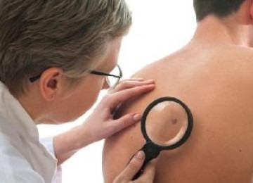 O melanoma pode se desenvolver em qualquer parte do corpo, mesmo em locais que não recebem muita exposição solar, como os pés -  (crédito: Freepik)