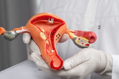 Os sintomas podem ser confundidos com outras doenças ginecológicas, gastrointestinais ou urológicas -  (crédito: FreePik)