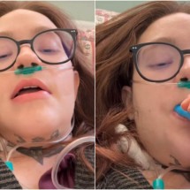 Mineira com a 'pior dor do mundo' sai do coma induzido; veja vídeo