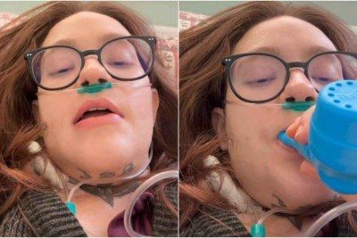 Carolina Arruda Leite, de 28 anos, foi diagnosticada com neuralgia do trigêmeo, condição rara conhecida como a 'pior dor do mundo' -  (crédito: Carolina Arruda/Instagram/Reprodução)