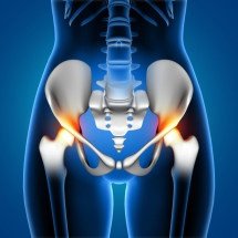 Cirurgias de quadril podem ser vitais para a mobilidade e qualidade de vida - kjpargeter/FreePik