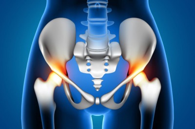 Os principais sinais da osteonecrose incluem dores intensas na região da virilha e quadris -  (crédito: kjpargeter/FreePik)