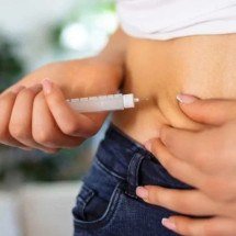 Canetas emagrecedoras ficarão fora do Sistema Único de Saúde - Freepik/reprodução