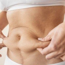 A estética da recuperação: como fica a beleza depois do emagrecimento - Freepik