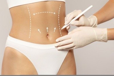 Cirurgia plástica corporal e de rejuvenescimento é tendência -  (crédito: DINO)